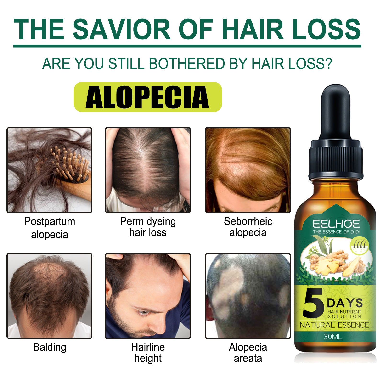 Eelhoe Ginger Hair Essential Oil. Eelhoe Ginger Hair Essential Oil - Opaline Glam Beauty