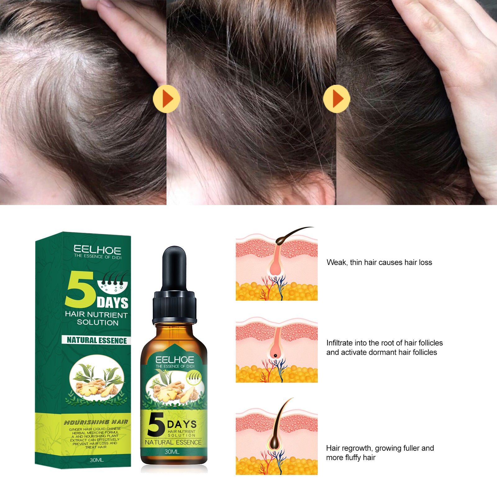 Eelhoe Ginger Hair Essential Oil. Eelhoe Ginger Hair Essential Oil - Opaline Glam Beauty