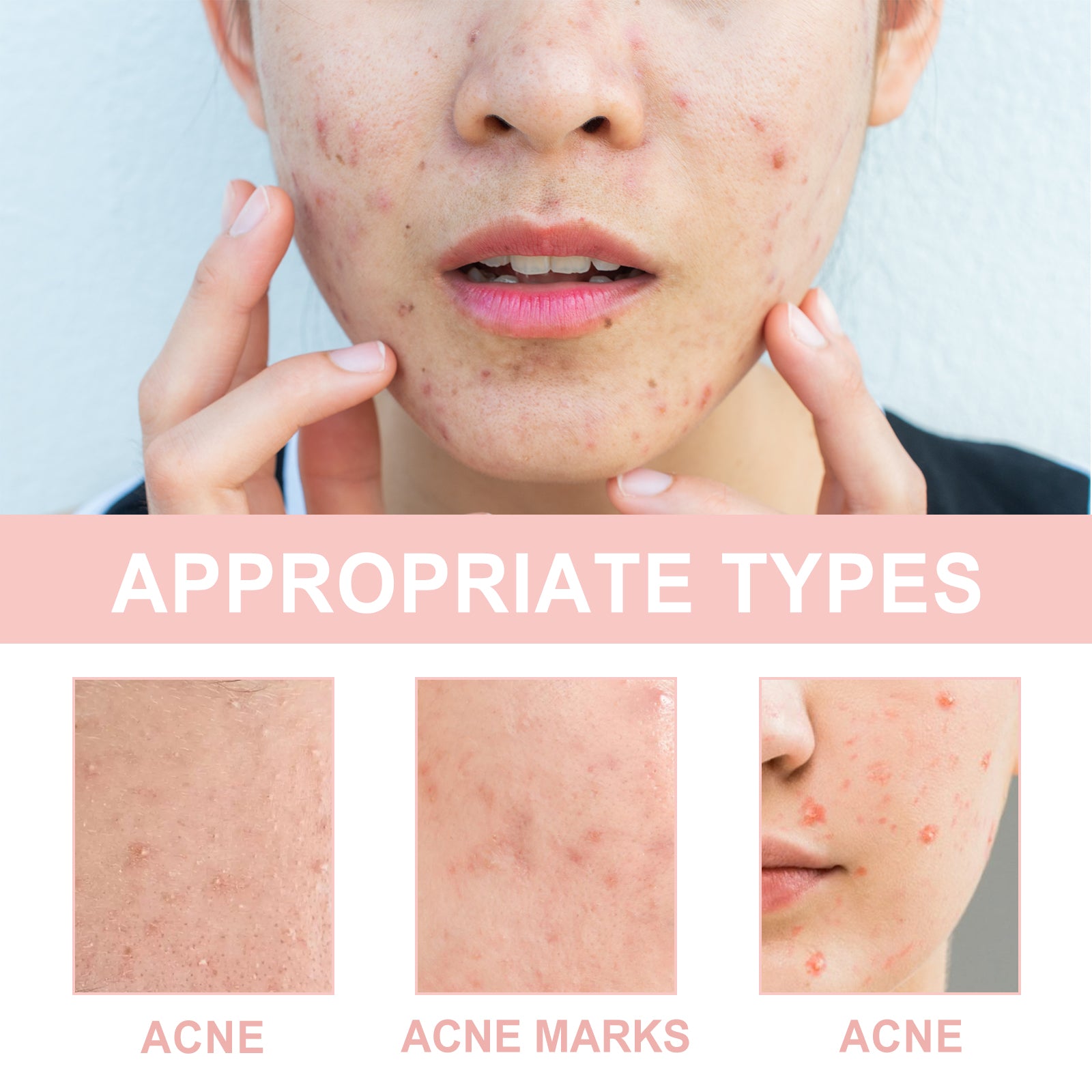 OUHOE Acne Repair & Pore Cleansing Patch