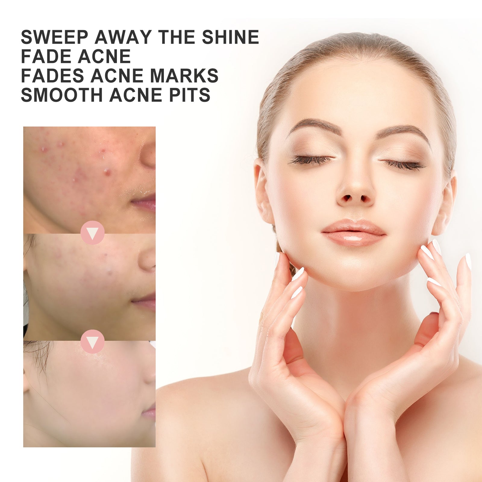 OUHOE Acne Repair & Pore Cleansing Patch