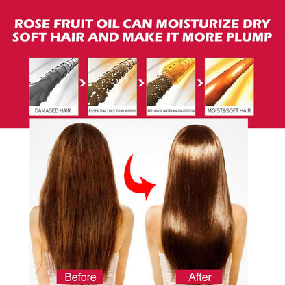 Rosehip Oil for Face, Body &amp; Hair – Hydration &amp; Care