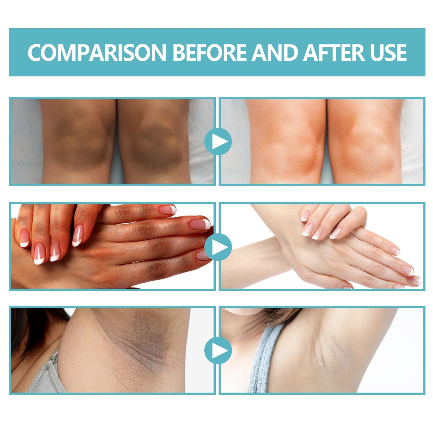EELHOE Black Echinacea Whitening Body Repair Cream