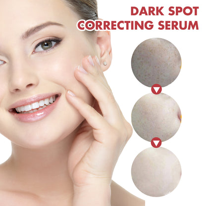 Hoygi Dark Spot Corrector Essence – Brighten &amp; Moisturize Skin