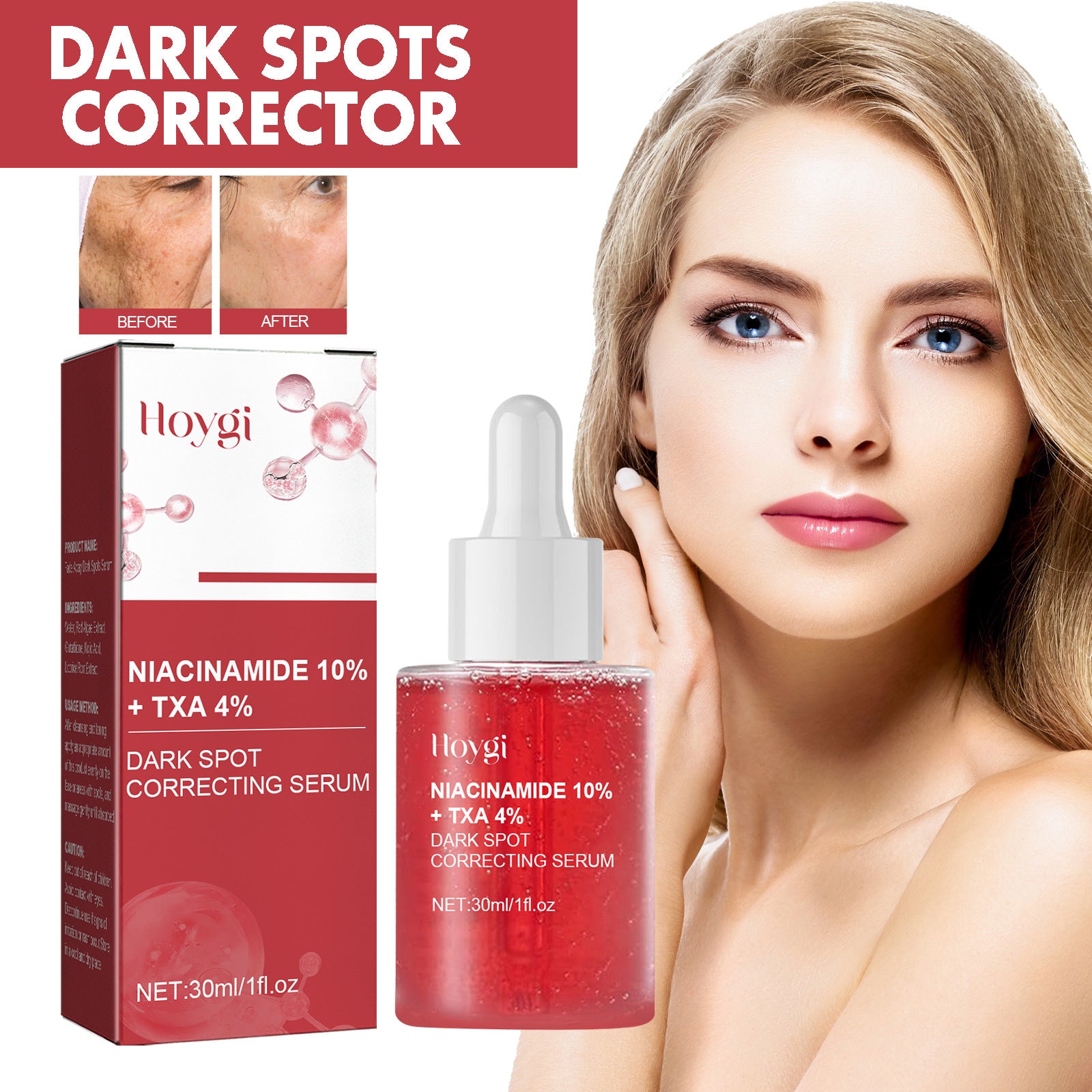Hoygi Dark Spot Corrector Essence – Brighten &amp; Moisturize Skin