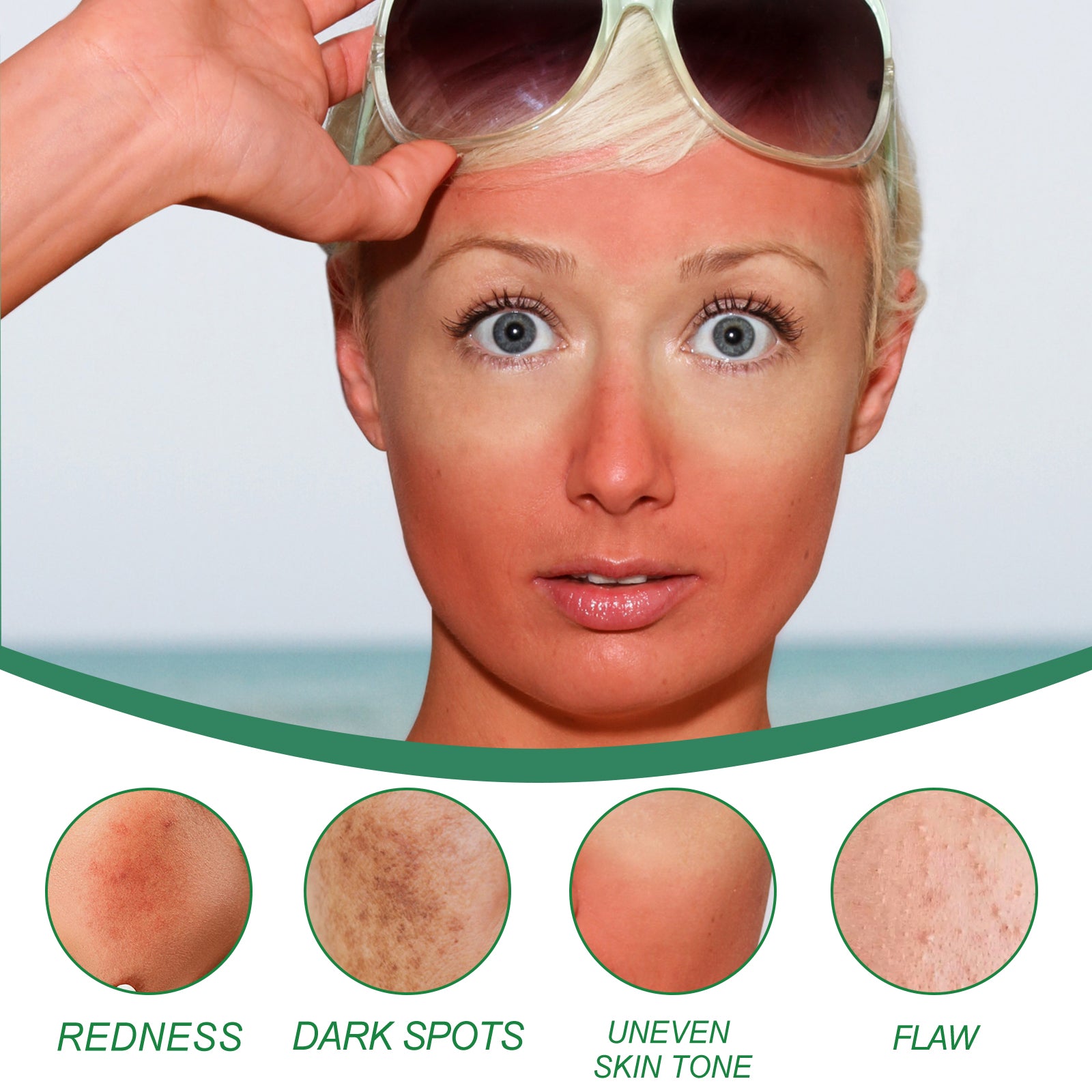 West&amp;Month Color Correcting &amp; Dark Spot Care Cream