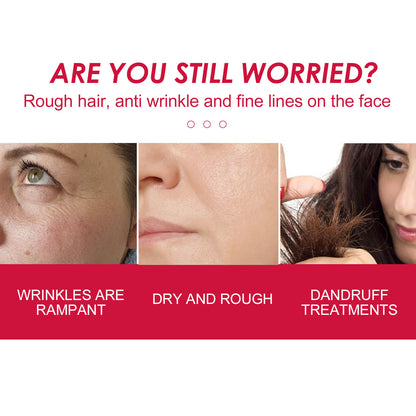 Rosehip Oil for Face, Body &amp; Hair – Hydration &amp; Care