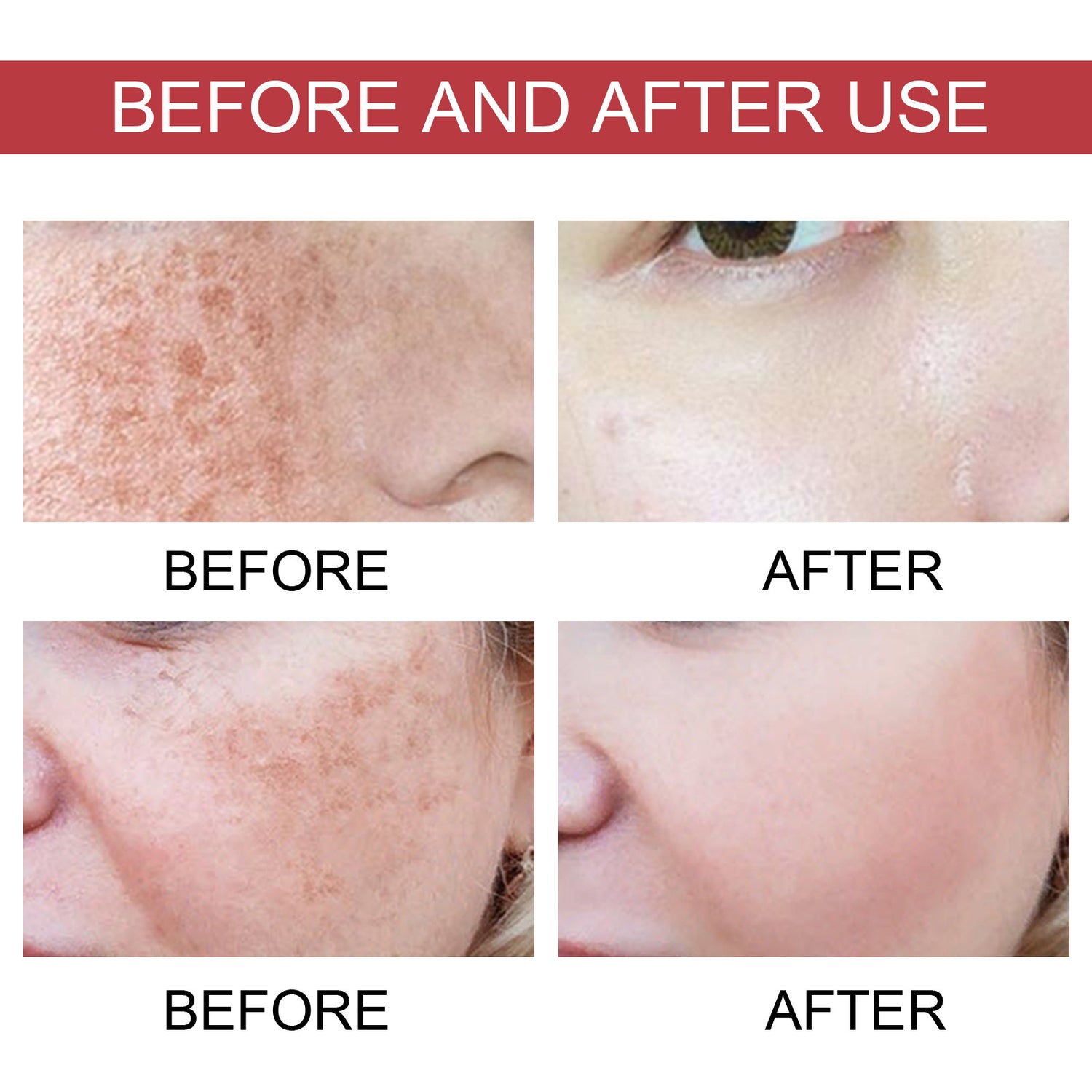 Hoygi Dark Spot Corrector Essence – Brighten &amp; Moisturize Skin