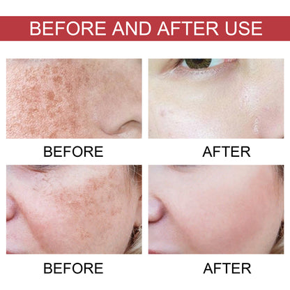Hoygi Dark Spot Corrector Essence – Brighten &amp; Moisturize Skin