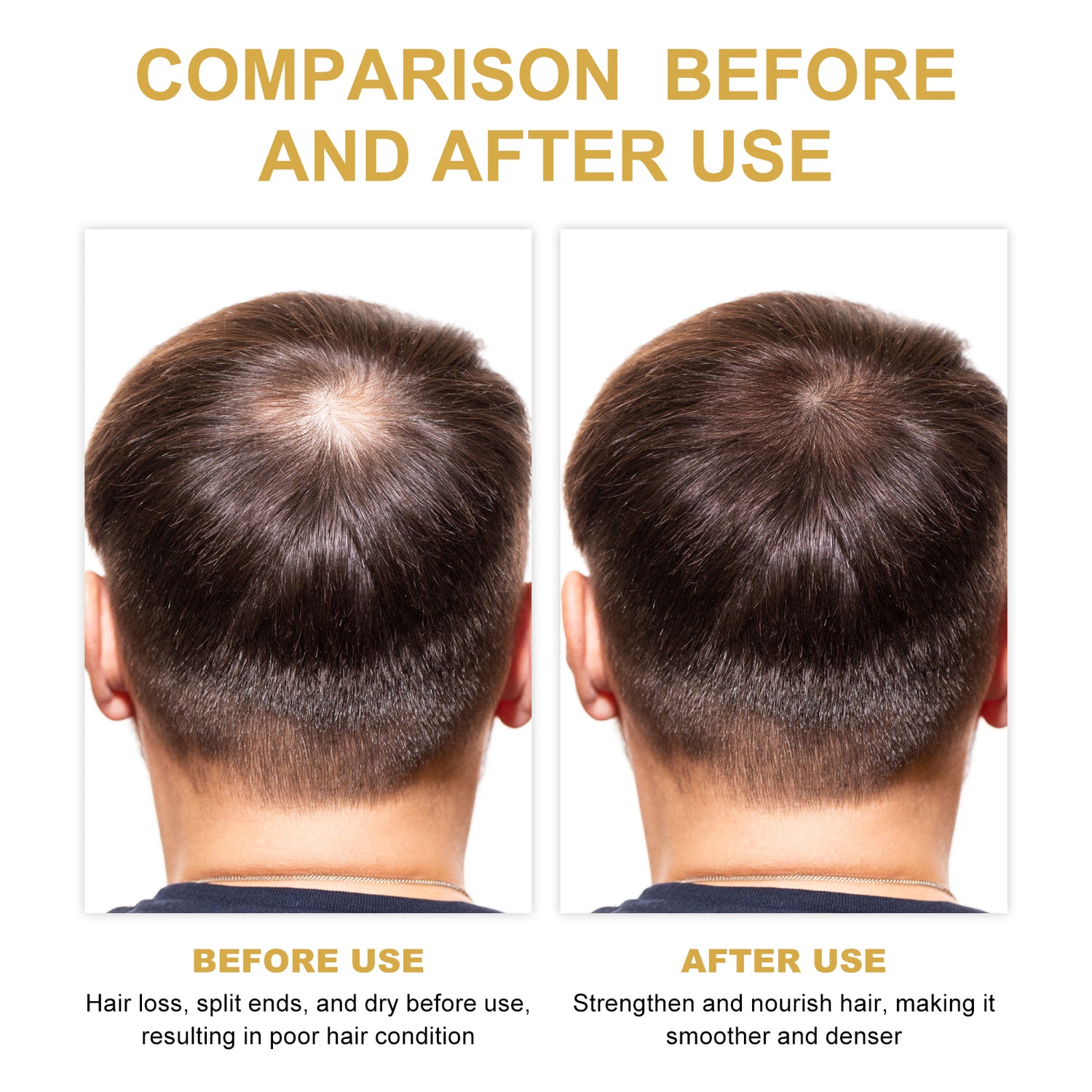 Rosemary Hair Oil – Scalp Care, Repair &amp; Volumizing
