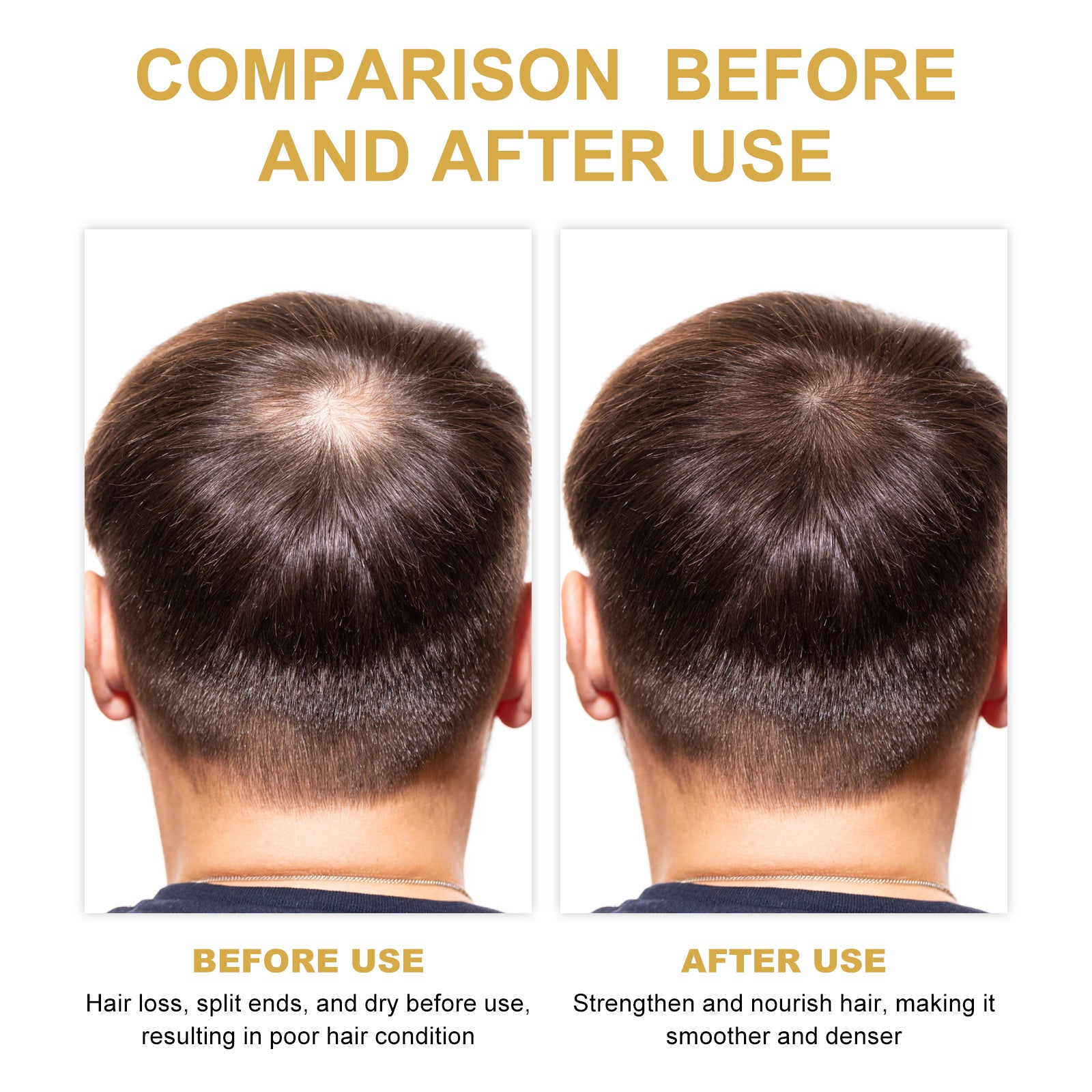 Rosemary Hair Oil – Scalp Care, Repair &amp; Volumizing
