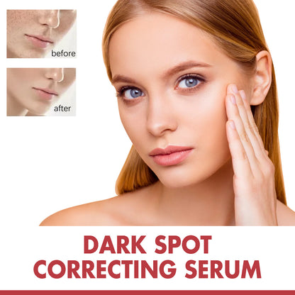Hoygi Dark Spot Corrector Essence – Brighten &amp; Moisturize Skin